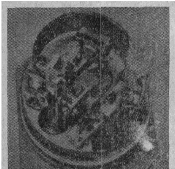 微型組件式壓力變送器的結構圖